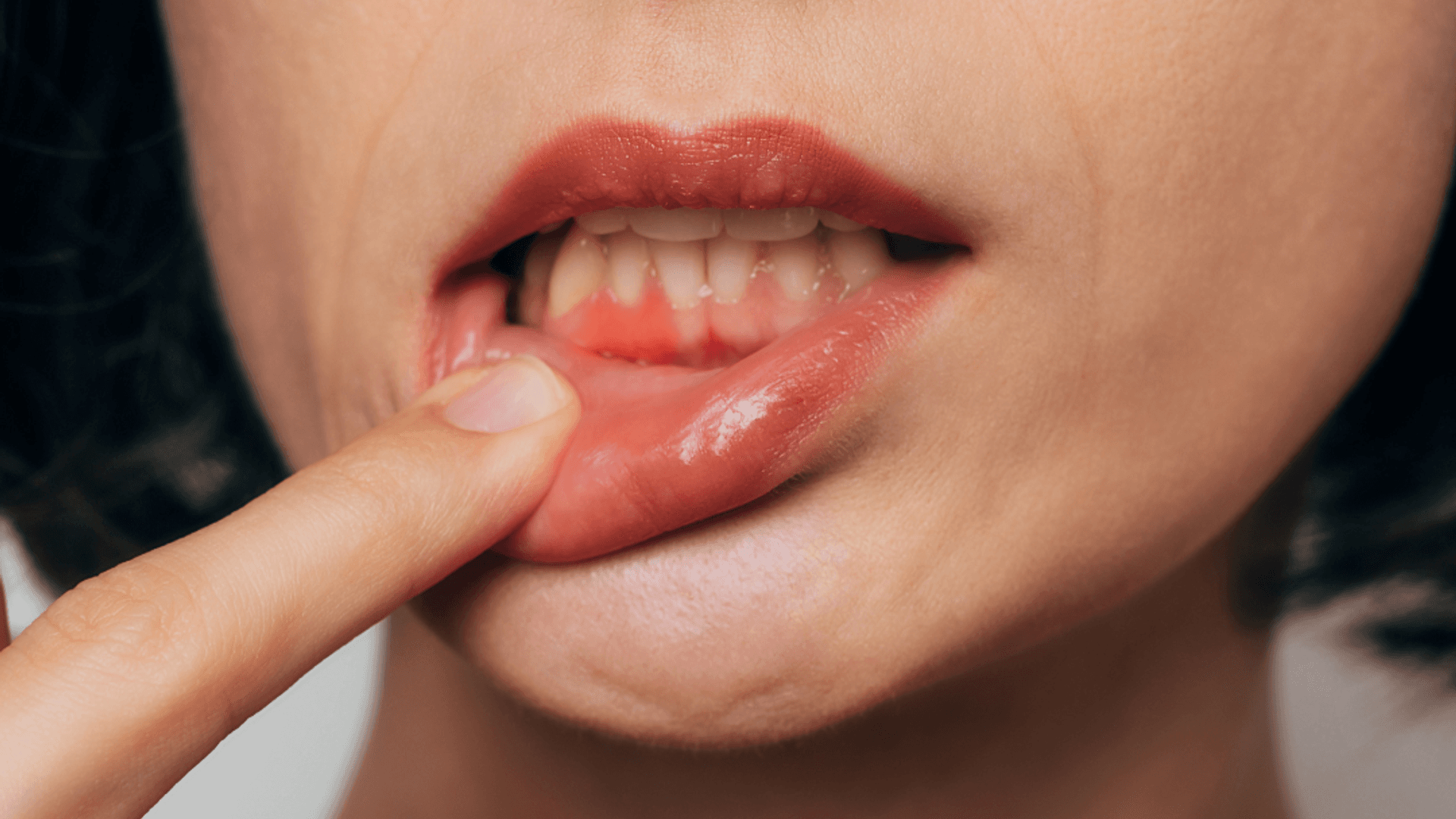 Periodontal Treatment