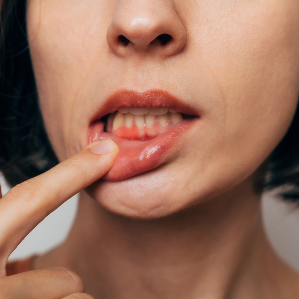 Periodontal Treatment
