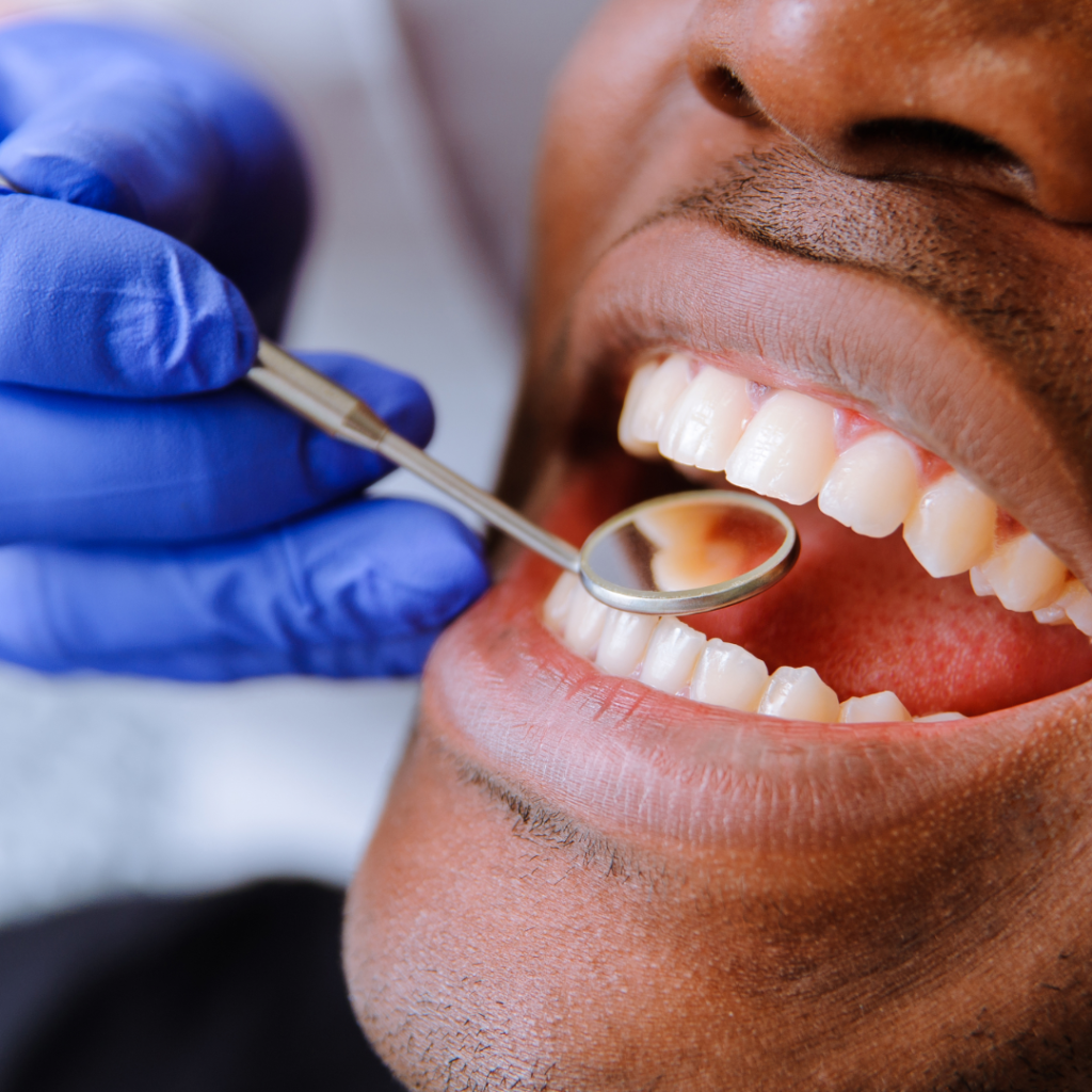 Dental Check up