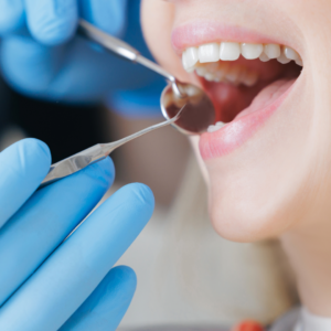 Dental